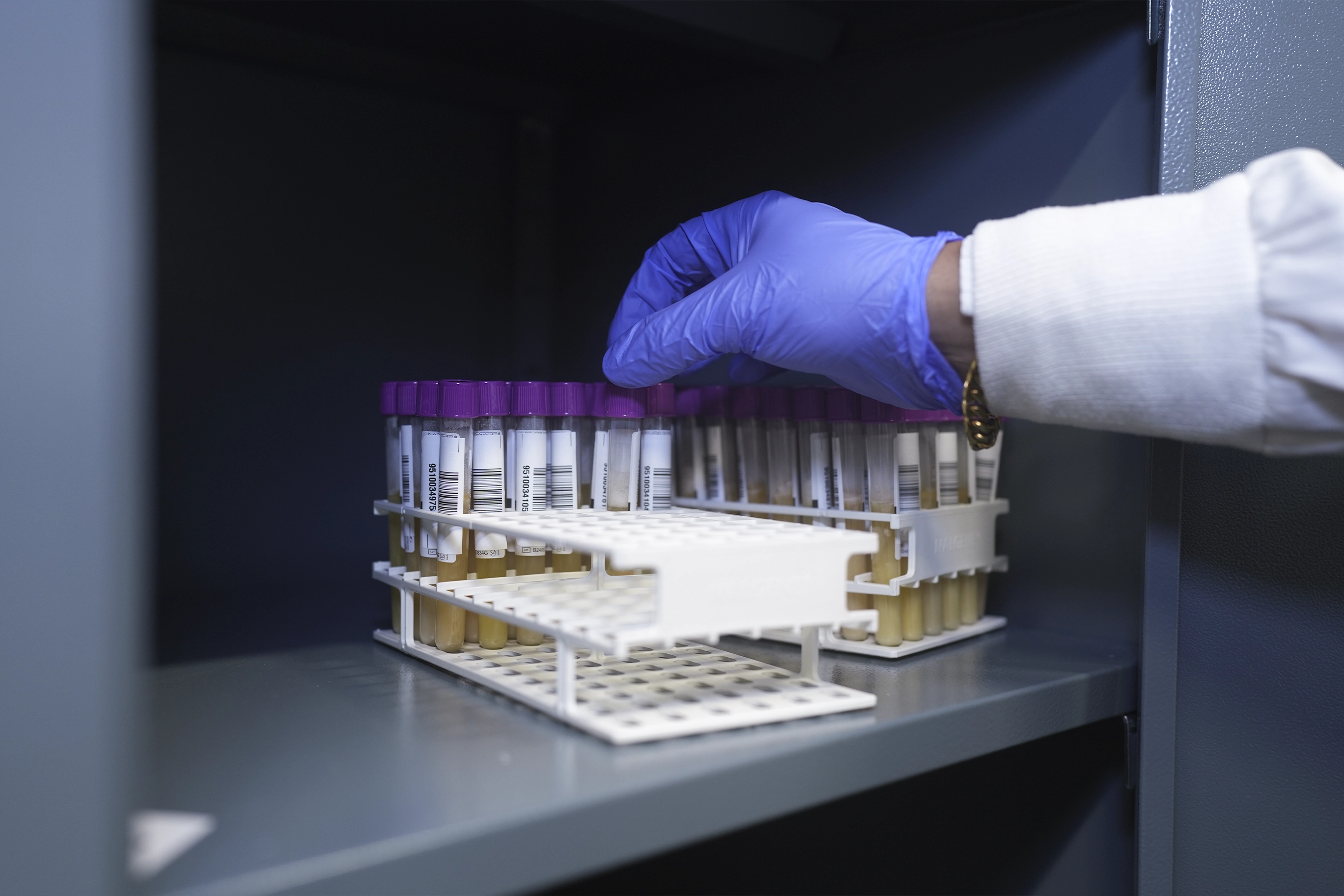 CURIOSIDADES DEL PLASMA